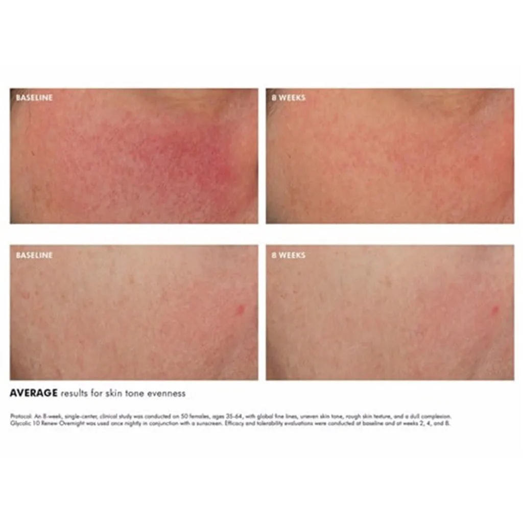 GLYCOLIC 10 RENEW OVERNIGHT
