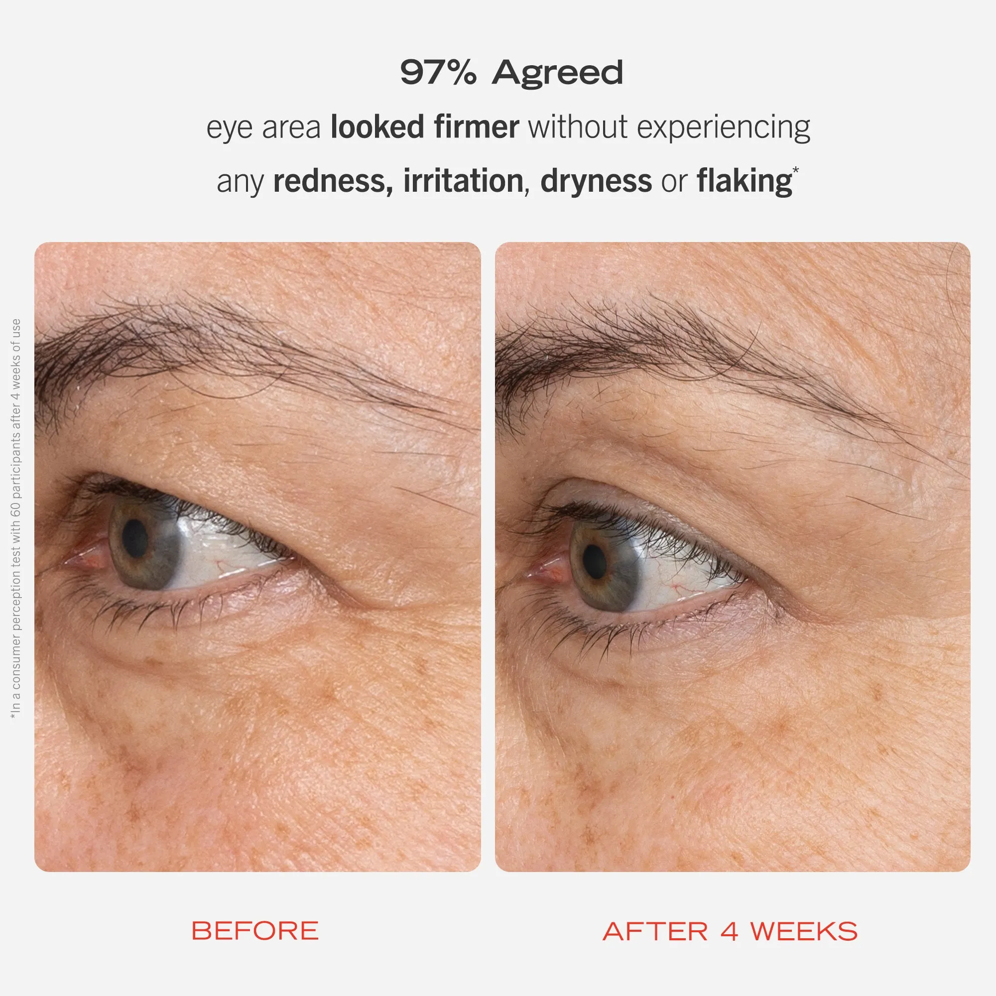 Retinol Eye Cream with Squalane   Ceramides