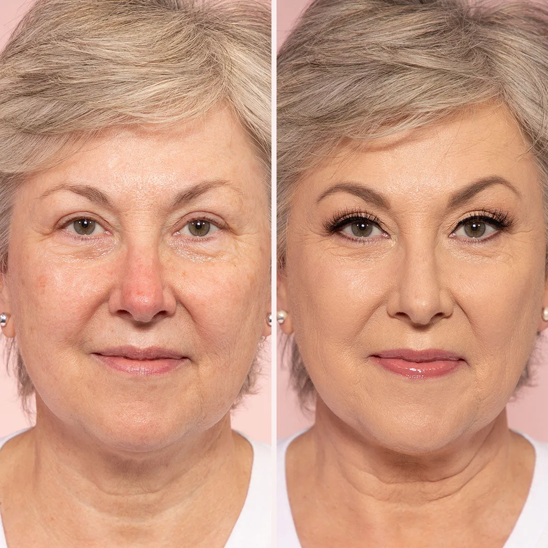 Smooth Skin Solutions 5-piece Collection