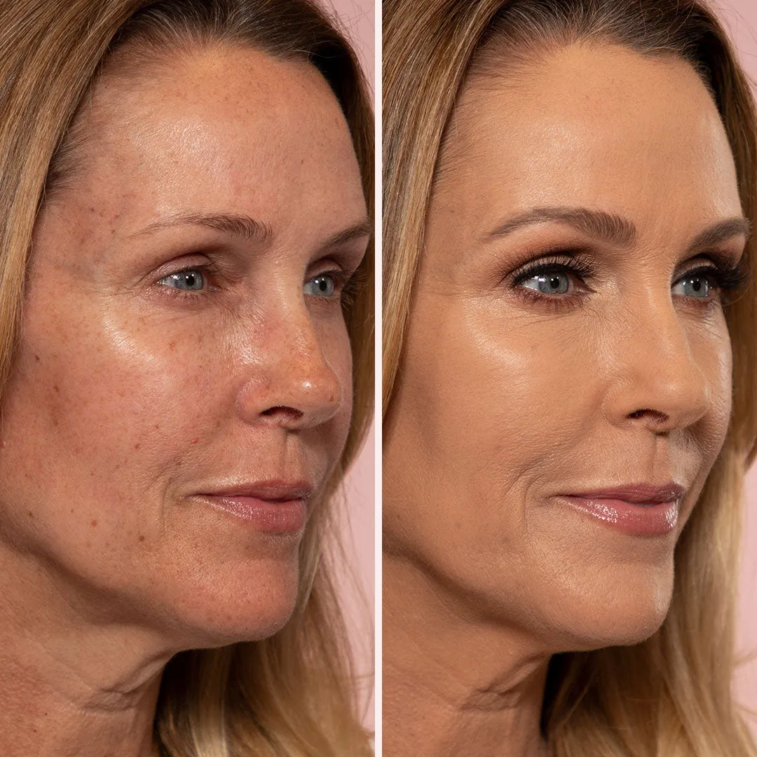 Smooth Skin Solutions 5-piece Collection